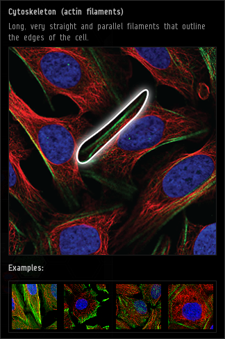 cytoskeleton_actin_filaments.png