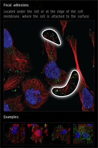 focal_adhesions.png