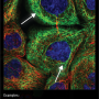 cytoskeleton_intermediate_filaments.png