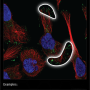 focal_adhesions.png