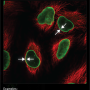 nuclear_membrane.png