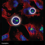 nucleoli.png